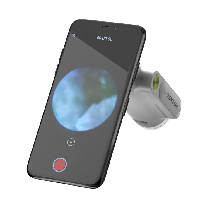 A gray portable microscope attached to a smartphone, showing a magnified circular image on the screen.